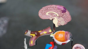 An anatomical model of a human brain